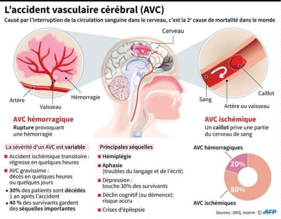 Comprendre Lavc Symptômes Risques Et Prévention Institut Amelis