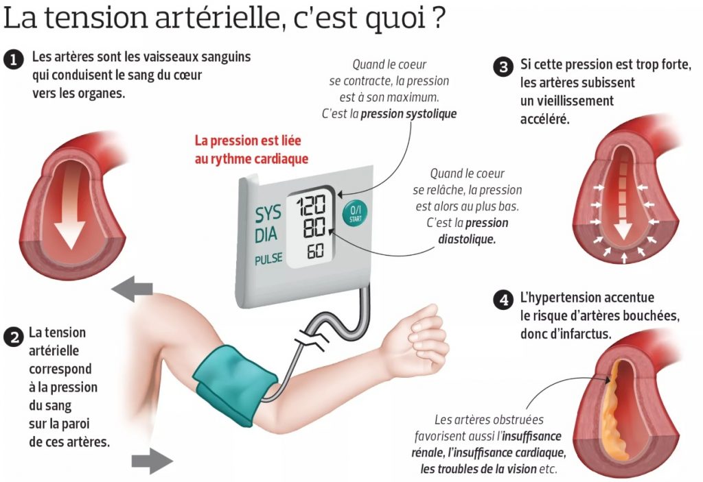 Prévention de l'hypertension artérielle Institut Amelis