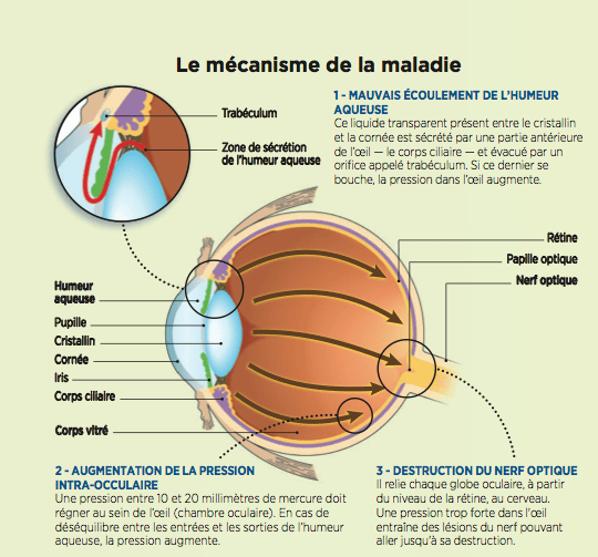 gouttes pour les yeux contre le glaucome