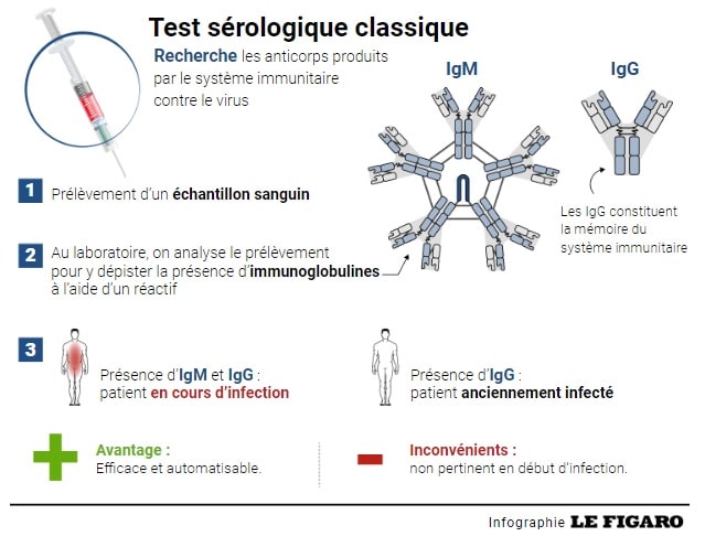 Depistage coronavirus sérologie - Source infographie lefigaro.fr