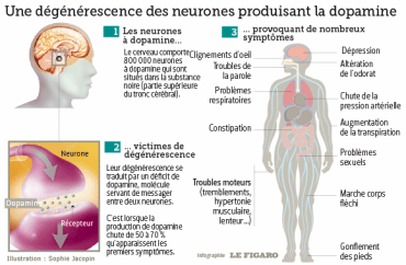 Quels sont les traitements de la maladie de Parkinson ? - Institut Amelis