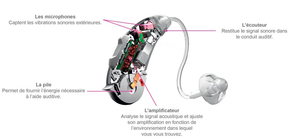Un appareil auditif se compose de plusieurs éléments distincts