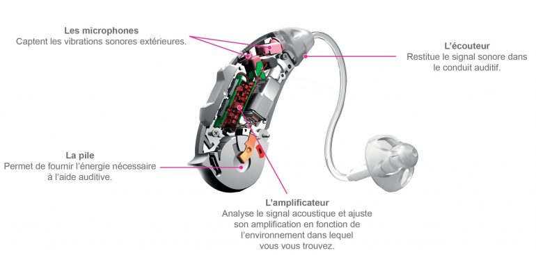 Comment Choisir Et Financer Son Appareil Auditif Pour Senior