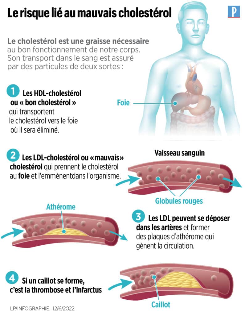 infographie décrivant les risques liés à un mauvais cholesterol